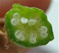Ovary T.S. (5-locular)